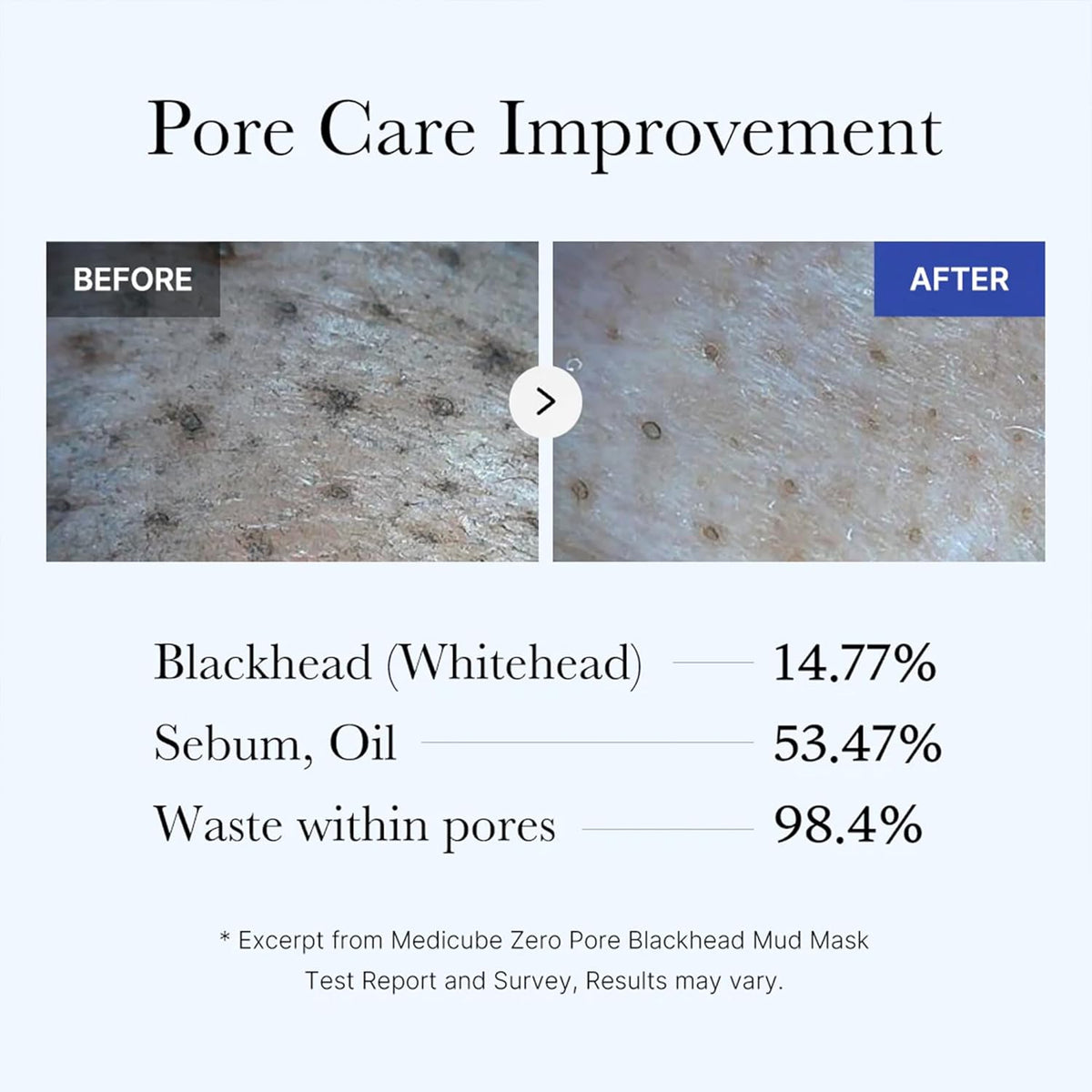 medicube Zero Pore Blackhead Mud Mask - Pore Cleansing & Gentle Exfoliating